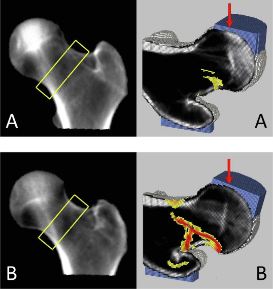 Digital Biomarkers